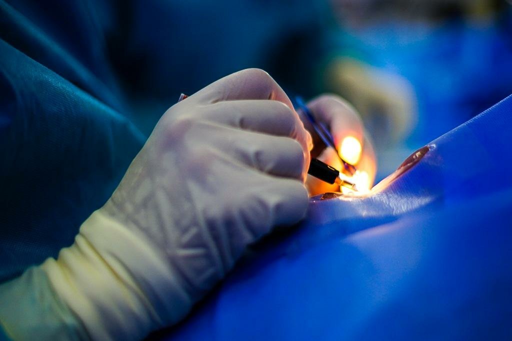 Cirugías de cataratas en Hospital Zacamil ha beneficiado a 500 salvadoreños en menos de una semana cirugias-de-cataratas-en-hospital-zacamil-ha-beneficiado-a-500-salvadorenos-en-menos-de-una-semana